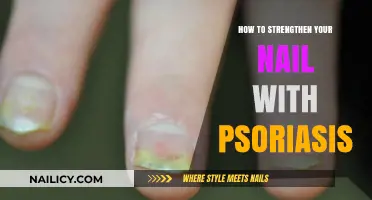 Effective Tips to Strengthen Nails Affected by Psoriasis Naturally