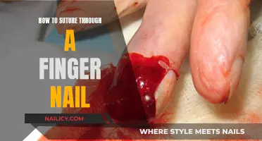 Suturing Fingernails: A Step-by-Step Guide for Quick Healing