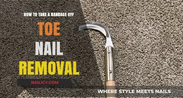 Easy Bandage Removal After Toe Nail Extraction