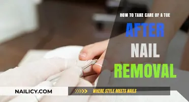 Toe Care: Post-Nail Removal Guide