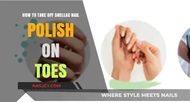 Easy Steps to Remove Shellac Nail Polish from Your Toes