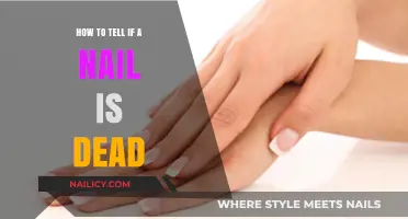 Identifying Dead Nails: Signs, Causes, and Treatment Options Explained