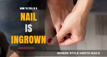 Identifying Ingrown Nails: Symptoms, Causes, and Early Detection Tips