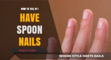 Identifying Spoon Nails: Symptoms, Causes, and When to Seek Help