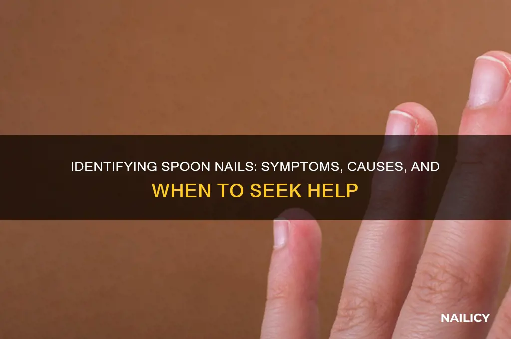 how to tell if i have spoon nails