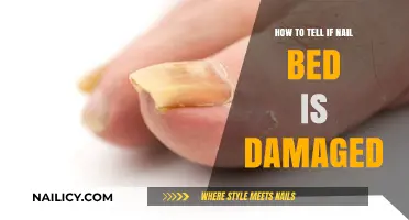 Signs of Damaged Nail Beds: How to Identify and Treat Them