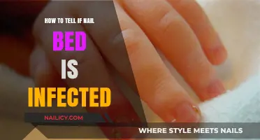 Spotting Nail Bed Infections: Symptoms, Causes, and Treatment Tips