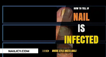 Identifying Infected Nails: Symptoms, Causes, and Treatment Options Explained