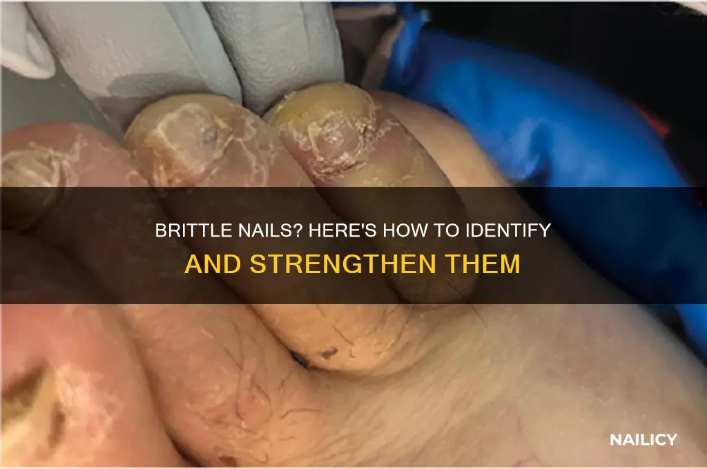 how to tell if nails are brittle