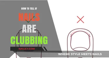 Recognizing Clubbed Nails: Key Signs and Symptoms to Watch For