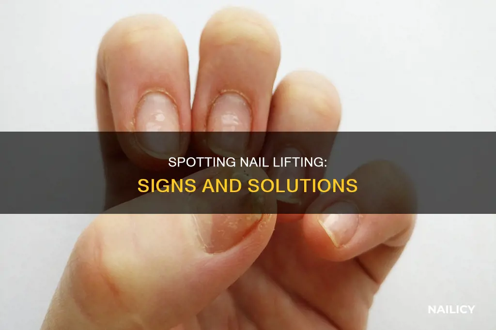 how to tell if nails is lifting at grow out