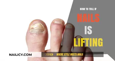 Spotting Nail Lifting: Signs, Causes, and Quick Fixes for Healthy Nails