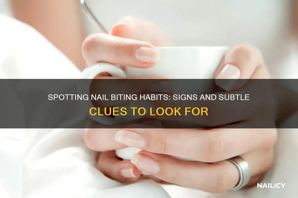how to tell if someone bites their nails