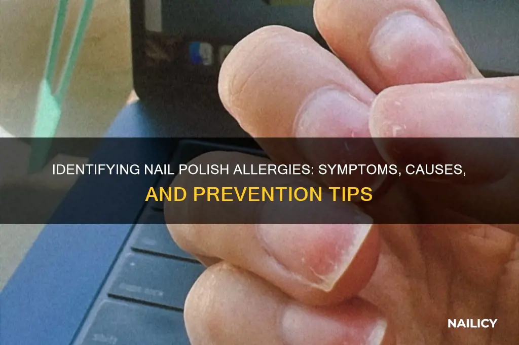 how to tell if you are allergic to nail polish