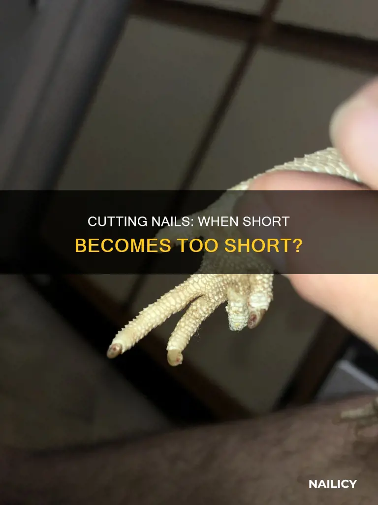 how to tell if you cut finger nails too short