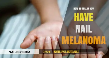 Spotting Nail Melanoma: Early Signs and Symptoms to Watch For