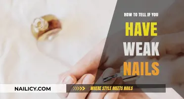 Weak Nails? Signs, Causes, and Solutions for Brittle Nail Health