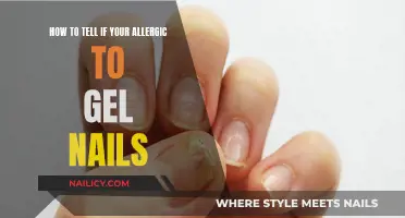Gel Nails: Allergic Reactions and You