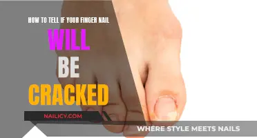 Recognizing Signs of Brittle Nails and Preventing Breaks