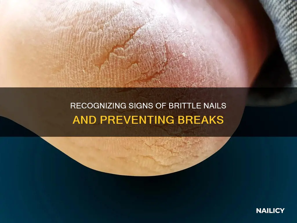 how to tell if your finger nail will be cracked