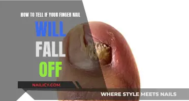 Signs Your Fingernail Will Fall Off