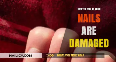 Spotting Damaged Nails: Signs, Causes, and Quick Remedies to Restore Health