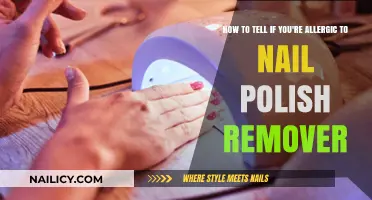 Spotting Nail Polish Remover Allergies: Signs and Symptoms
