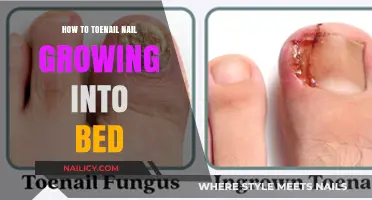Toenail Emergencies: Growing Pains and Practical Solutions