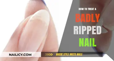 Quick Fixes for a Badly Ripped Nail: Healing Tips and Tricks