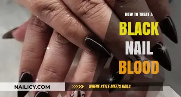 Effective Treatment Tips for Black Nail Blood: A Comprehensive Guide