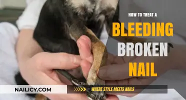 Quick Fix for Bleeding Broken Nails: Effective Treatment Tips