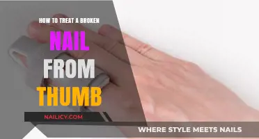Quick Fixes for a Broken Thumb Nail: Healing Tips and Tricks