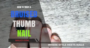 Effective Remedies for Healing a Bruised Thumb Nail Quickly