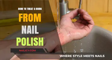 Quick Relief: Treating Nail Polish Burns Safely and Effectively