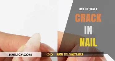 Effective Ways to Treat and Repair a Cracked Nail