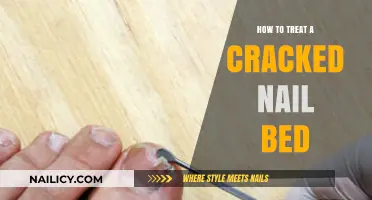 Heal and Repair: Effective Treatments for Cracked Nail Beds