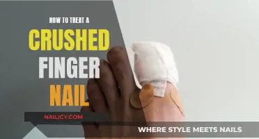Treat a Crushed Fingernail: Quick and Easy Home Remedies