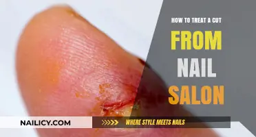 Treating Nail Salon Cuts: A Quick Guide