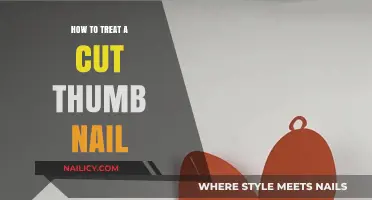 Treating Thumb Nail Cuts: Quick and Easy Home Remedies