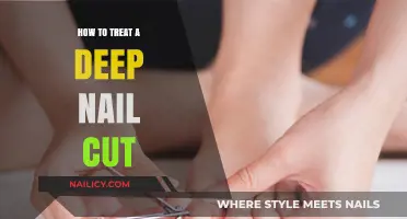 Treating Deep Nail Cuts: Quick and Easy Home Remedies