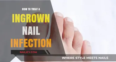Effective Treatment Tips for Painful Ingrown Nail Infections at Home