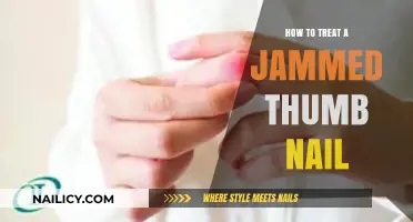 Quick Relief: Effective Ways to Treat a Jammed Thumb Nail