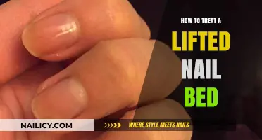 Healing a Lifted Nail Bed: Effective Treatment and Care Tips