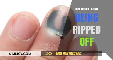 Emergency Nail Care: Treating a Ripped-Off Nail Effectively and Safely