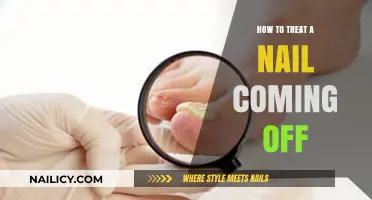Effective Ways to Treat a Nail Coming Off: Tips and Remedies