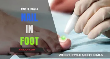 Effective Ways to Treat a Painful Nail in Your Foot