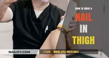 Effective Treatment for a Nail Embedded in the Thigh: A Guide