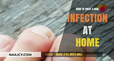 Effective Home Remedies for Treating Nail Infections Naturally and Safely