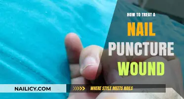 Effective Treatment Steps for Nail Puncture Wounds: A Comprehensive Guide