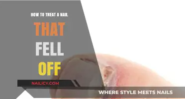 Effective Ways to Treat and Heal a Nail That Fell Off